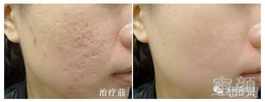 https://img.miyanlife.com/mnt/timg/191121/125F24553-5.jpg