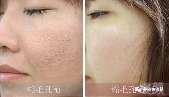 https://img.miyanlife.com/mnt/timg/191121/125F3L50-6.jpg