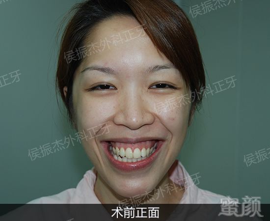 https://img.miyanlife.com/mnt/timg/191121/132140NQ-3.jpg