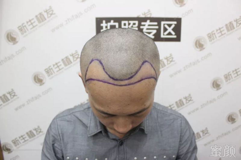 https://img.miyanlife.com/mnt/timg/191122/125A64212-1.jpg
