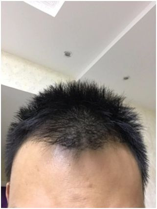 https://img.miyanlife.com/mnt/timg/191122/13021H916-0.jpg