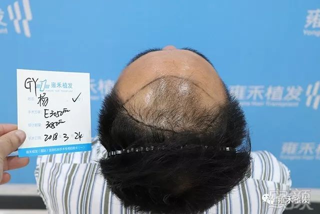 https://img.miyanlife.com/mnt/timg/191122/1306105329-3.jpg