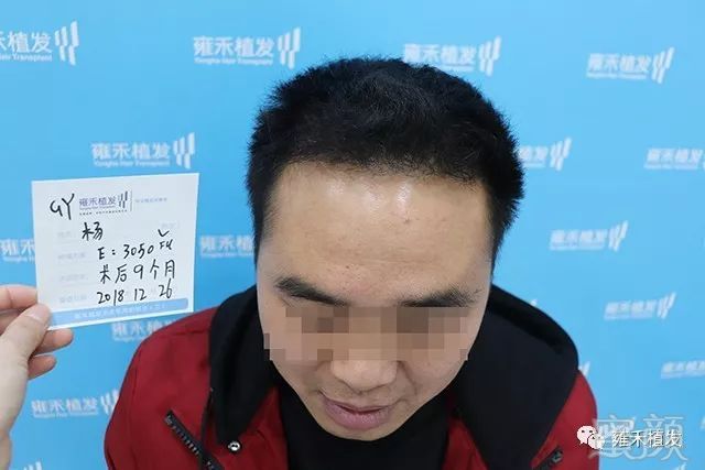 https://img.miyanlife.com/mnt/timg/191122/1306121007-11.jpg