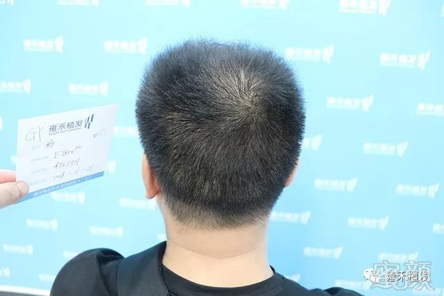 https://img.miyanlife.com/mnt/timg/191122/1306122015-9.jpg