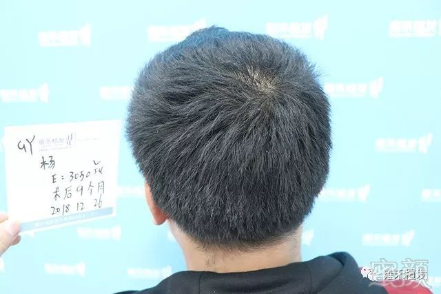 https://img.miyanlife.com/mnt/timg/191122/1306131549-13.jpg