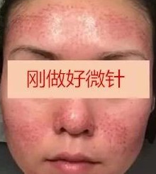 https://img.miyanlife.com/mnt/timg/191122/133U94D8-0.jpg