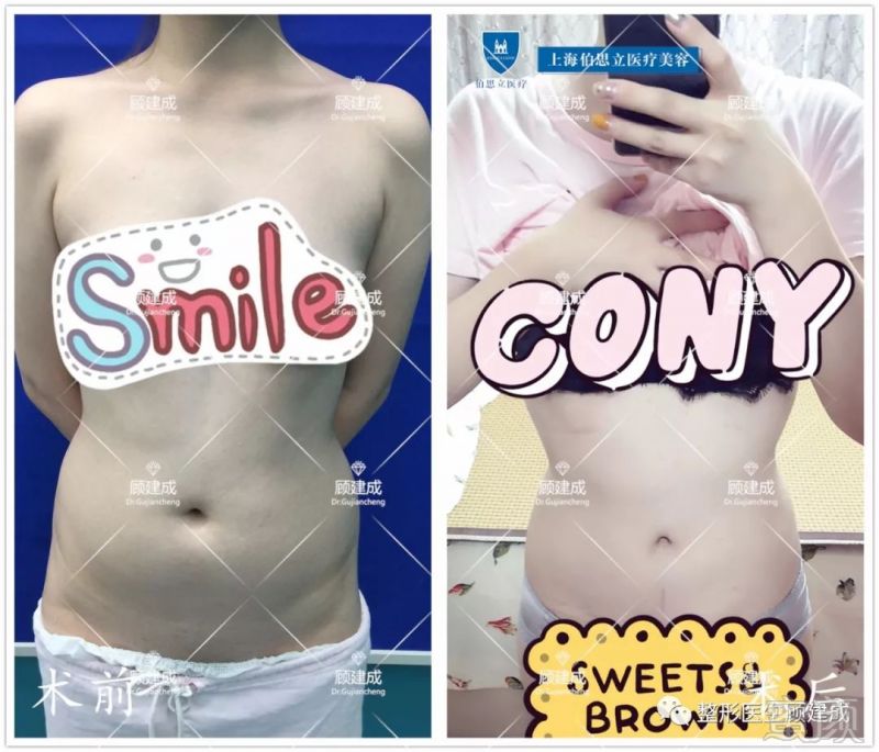 https://img.miyanlife.com/mnt/timg/191124/1204091309-2.jpg