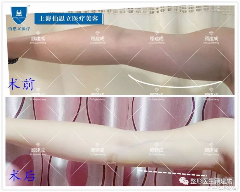 https://img.miyanlife.com/mnt/timg/191124/12040J3P-0.jpg
