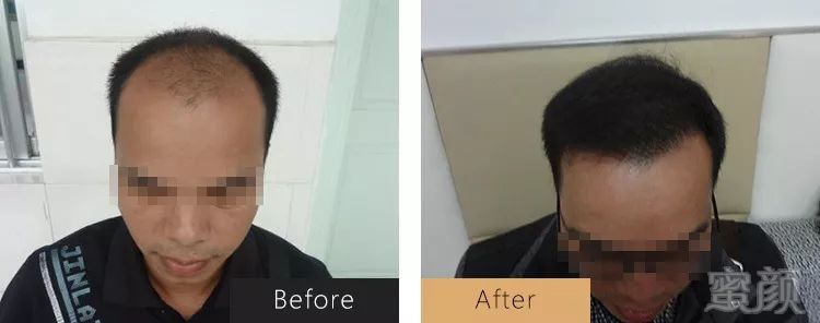 https://img.miyanlife.com/mnt/timg/191124/163P91T8-3.jpg