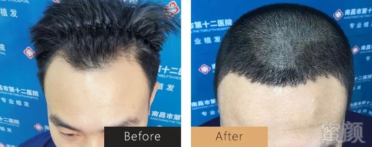 https://img.miyanlife.com/mnt/timg/191124/163PV2c-1.jpg