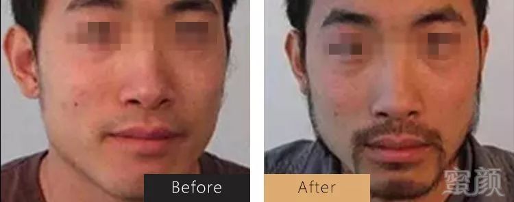 https://img.miyanlife.com/mnt/timg/191124/163Q03002-5.jpg