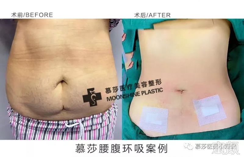 https://img.miyanlife.com/mnt/timg/191124/16411334Y-4.jpg
