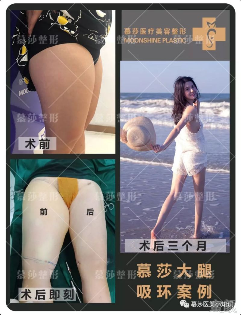 https://img.miyanlife.com/mnt/timg/191124/1641142D6-5.jpg