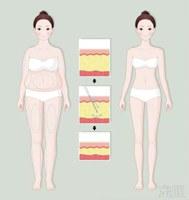 https://img.miyanlife.com/mnt/timg/191124/164JG444-2.jpg