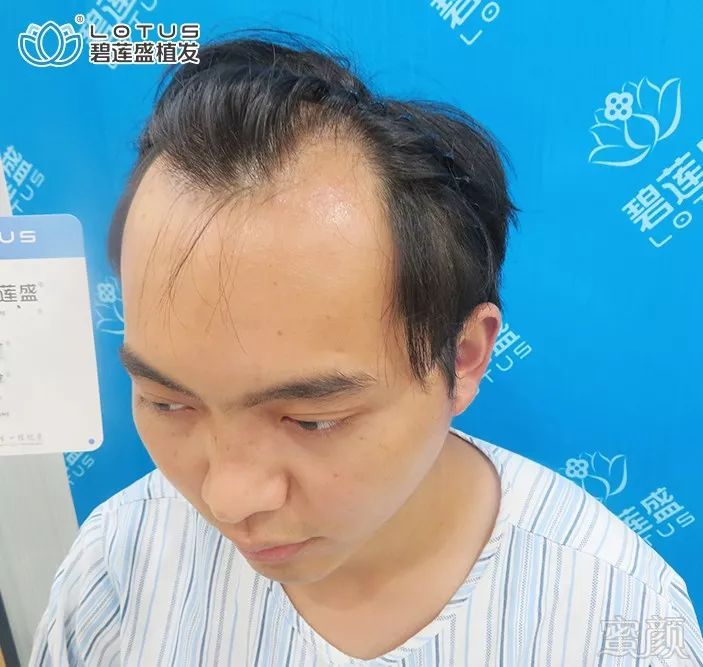 https://img.miyanlife.com/mnt/timg/191124/1A2305T9-1.jpg