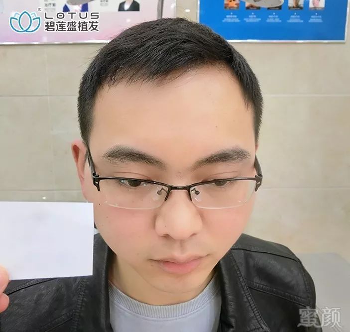 https://img.miyanlife.com/mnt/timg/191124/1A233D57-7.jpg