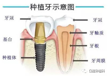 案例图片