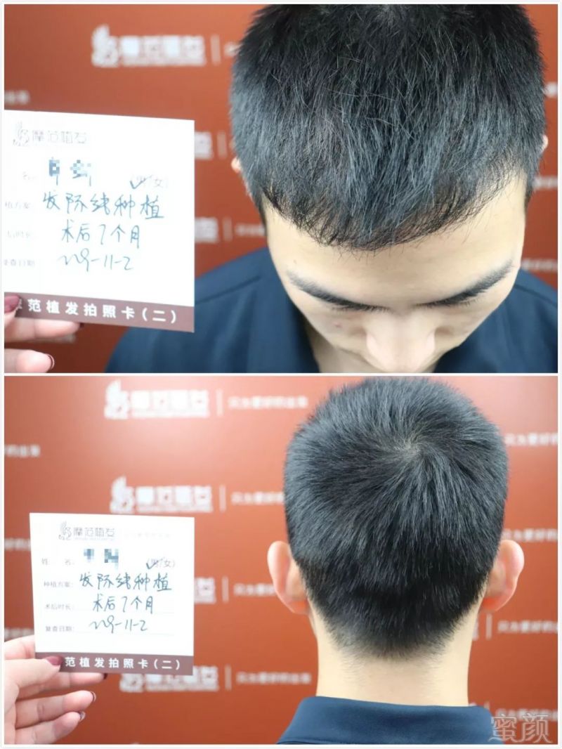 https://img.miyanlife.com/mnt/timg/191126/13521A052-10.jpg