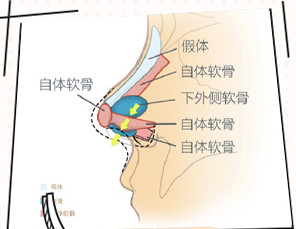 案例图片