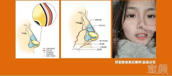 案例图片