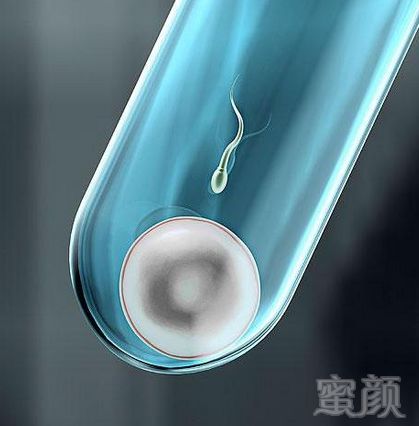 https://img.miyanlife.com/mnt/timg/191126/144U45W5-1.jpg