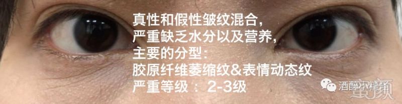 https://img.miyanlife.com/mnt/timg/191126/1459335c5-17.jpg