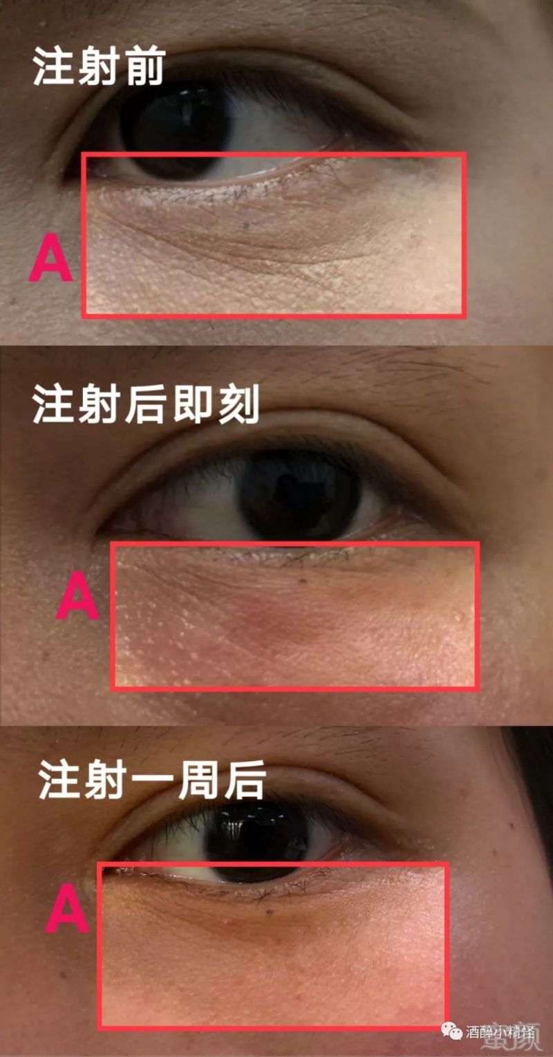 https://img.miyanlife.com/mnt/timg/191126/1459354F2-20.jpg
