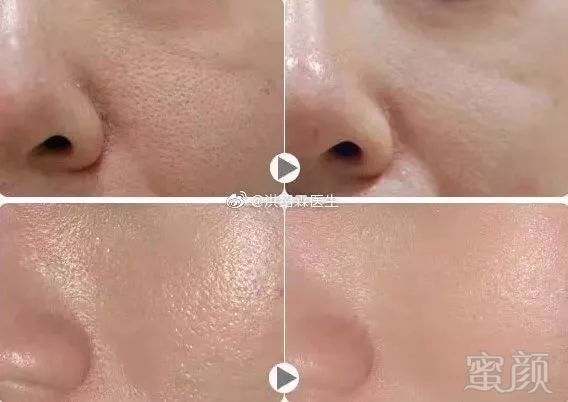 https://img.miyanlife.com/mnt/timg/191126/145A330L-9.jpg