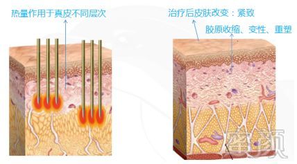 https://img.miyanlife.com/mnt/timg/191126/1501301F7-1.jpg