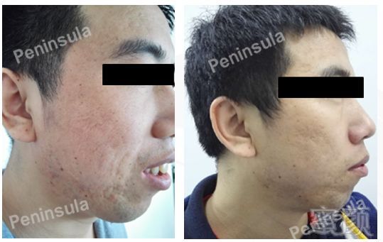 https://img.miyanlife.com/mnt/timg/191126/150132OB-4.jpg