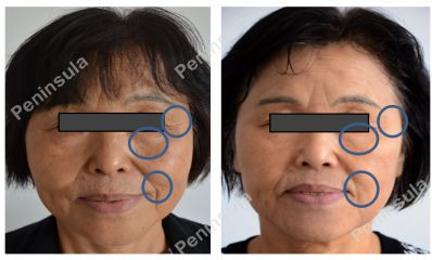 https://img.miyanlife.com/mnt/timg/191126/1501334601-6.jpg