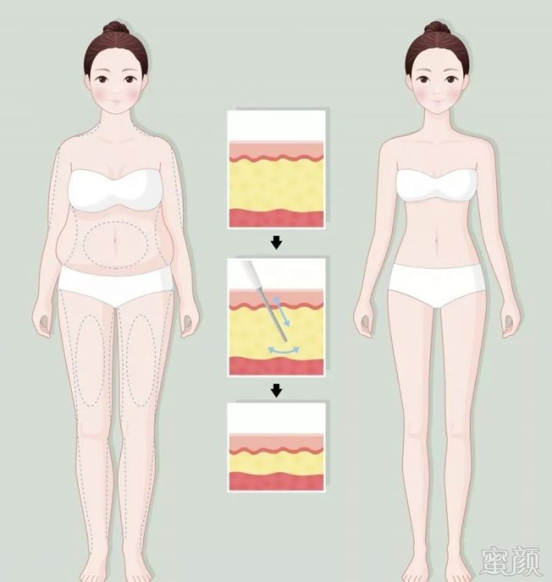 https://img.miyanlife.com/mnt/timg/191127/141009B91-4.jpg