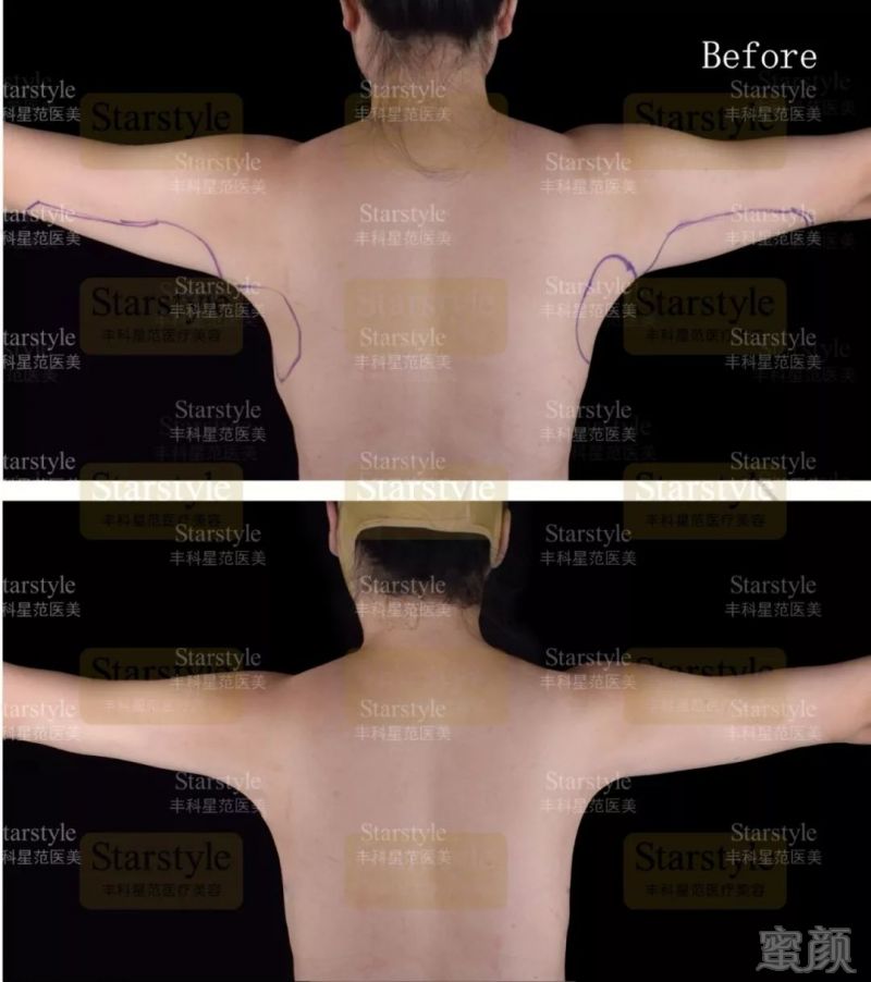https://img.miyanlife.com/mnt/timg/191127/1410143209-11.jpg