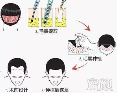 https://img.miyanlife.com/mnt/timg/191127/14115S645-1.jpg