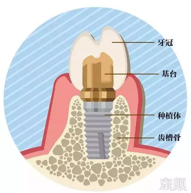 案例图片