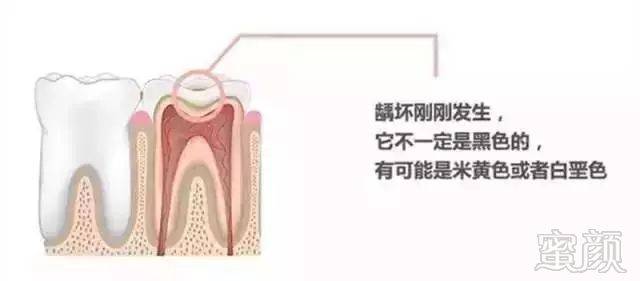 案例图片