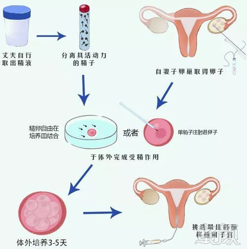 https://img.miyanlife.com/mnt/timg/191128/1309123959-1.jpg