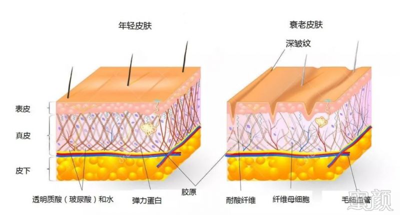 案例图片