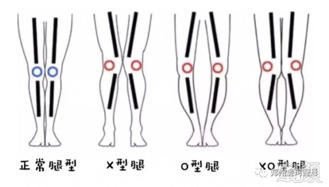 https://img.miyanlife.com/mnt/timg/191201/10362320G-5.jpg