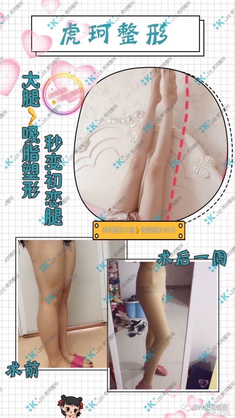 https://img.miyanlife.com/mnt/timg/191201/1036242T6-6.jpg