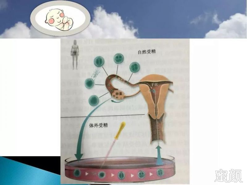 https://img.miyanlife.com/mnt/timg/191202/1322153018-6.jpg