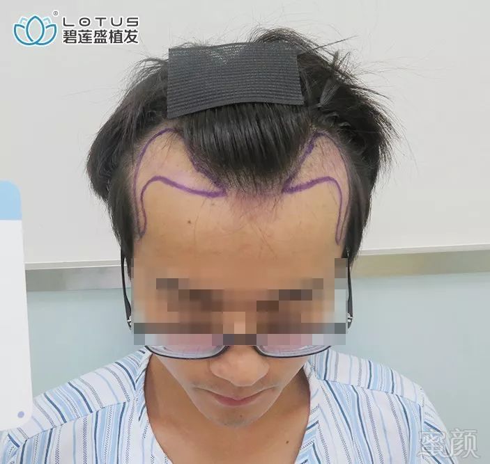 https://img.miyanlife.com/mnt/timg/191202/1342034I4-1.jpg