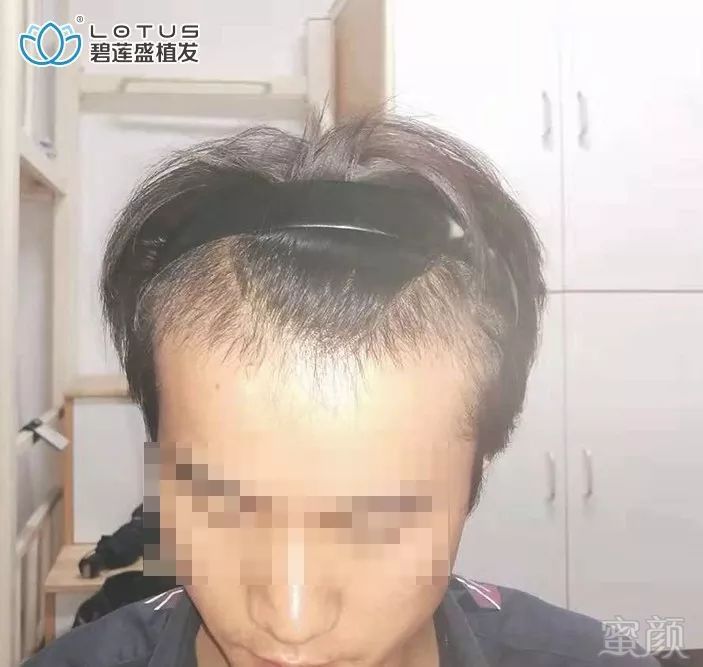 https://img.miyanlife.com/mnt/timg/191202/1342044364-3.jpg