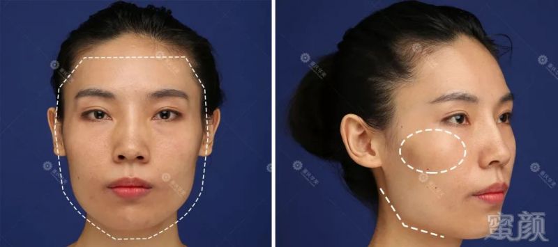 https://img.miyanlife.com/mnt/timg/191203/13533Q519-16.jpg