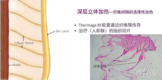 案例图片