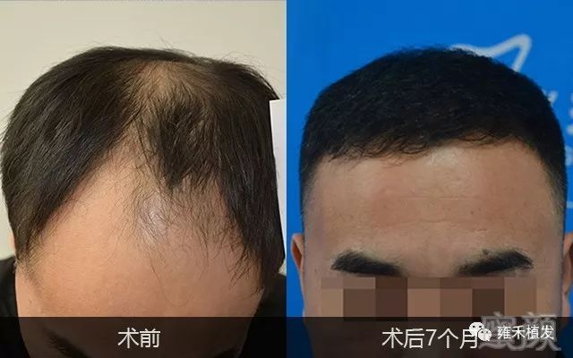 案例图片