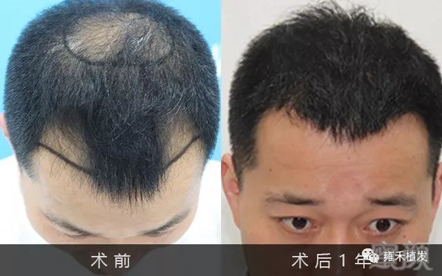 https://img.miyanlife.com/mnt/timg/191204/14355J015-0.jpg