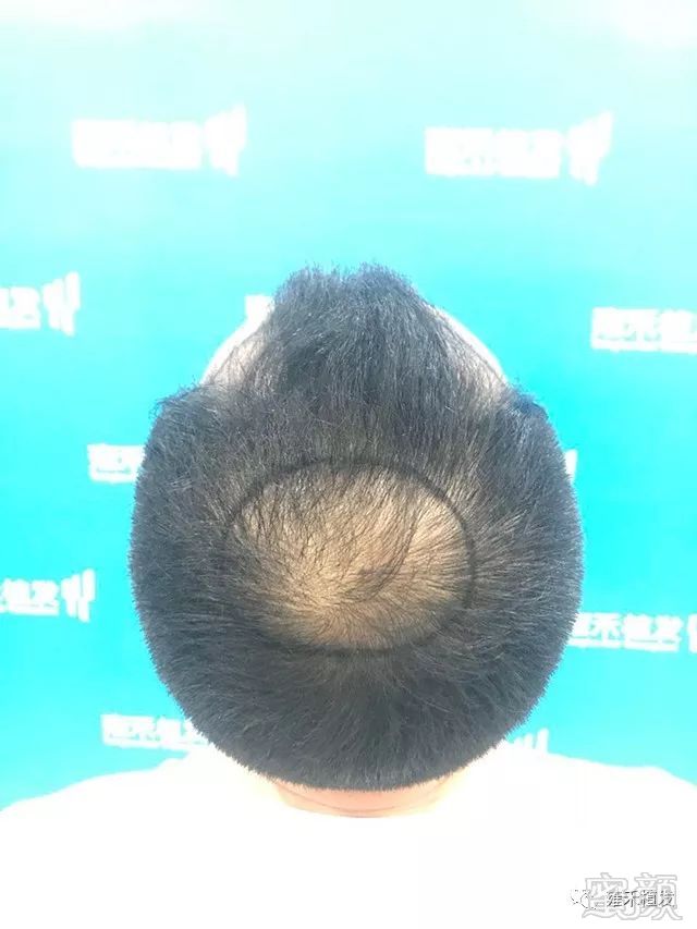 https://img.miyanlife.com/mnt/timg/191204/1436026026-3.jpg