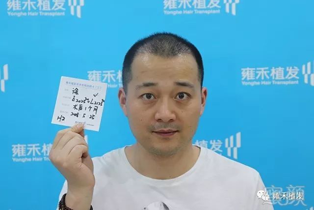 https://img.miyanlife.com/mnt/timg/191204/1436054U9-12.jpg
