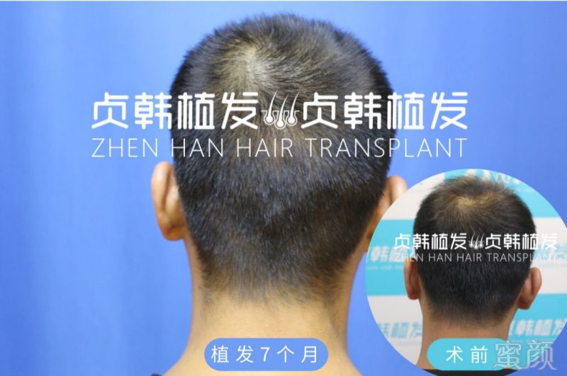 https://img.miyanlife.com/mnt/timg/191206/13550J1V-4.jpg